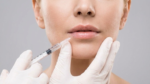 Hyaluron Lippen Aufspritzung in Dortmund