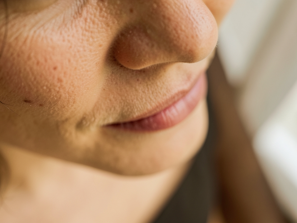 Natürliches Ergebnis nach einer Botox Lip Flip Behandlung – Botox Lip Flip Behandlung Dortmund
