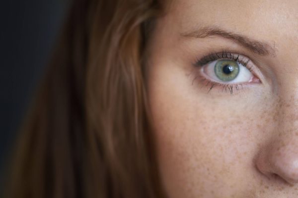 Pigmentflecken mit Laser behandeln Dortmund Pigmentflecken mit Laser behandeln Dortmund